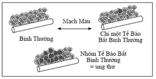 Tuyen tap 2 PGS - Benh ung thu 01